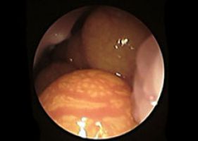 Tierarzt Dr. Heiner Müller bei der Endoskopie eines Spixara in AWWP, Qatar