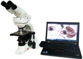 Fast alle parasitologischen Proben müssen mittels Mikroskop untersucht werden. Hier erfolgt die Auswertung mittels HD-Kamera am Bildschirm.